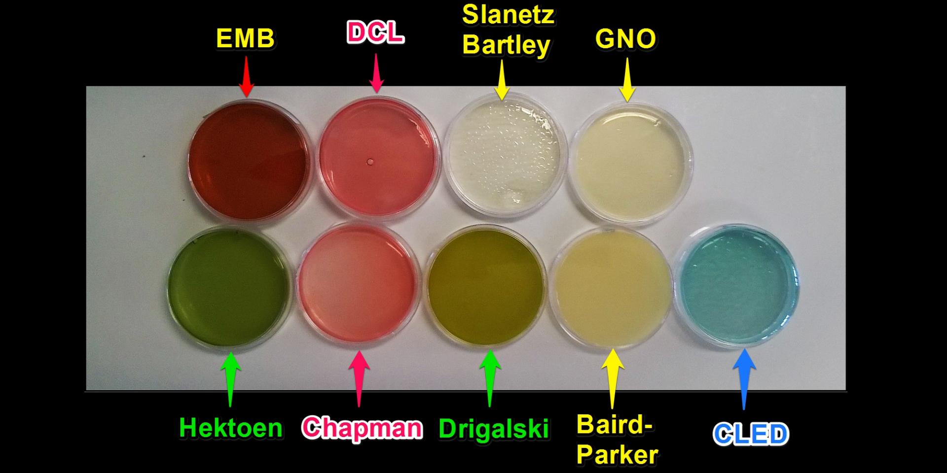 Mobestech 2 Pièces Diffuseur De Bactéries Outil De Diffusion Cellulaire  D'étalement De Cellules Épandeur De Glaçage Épandeur De Culture Épandeurs  De