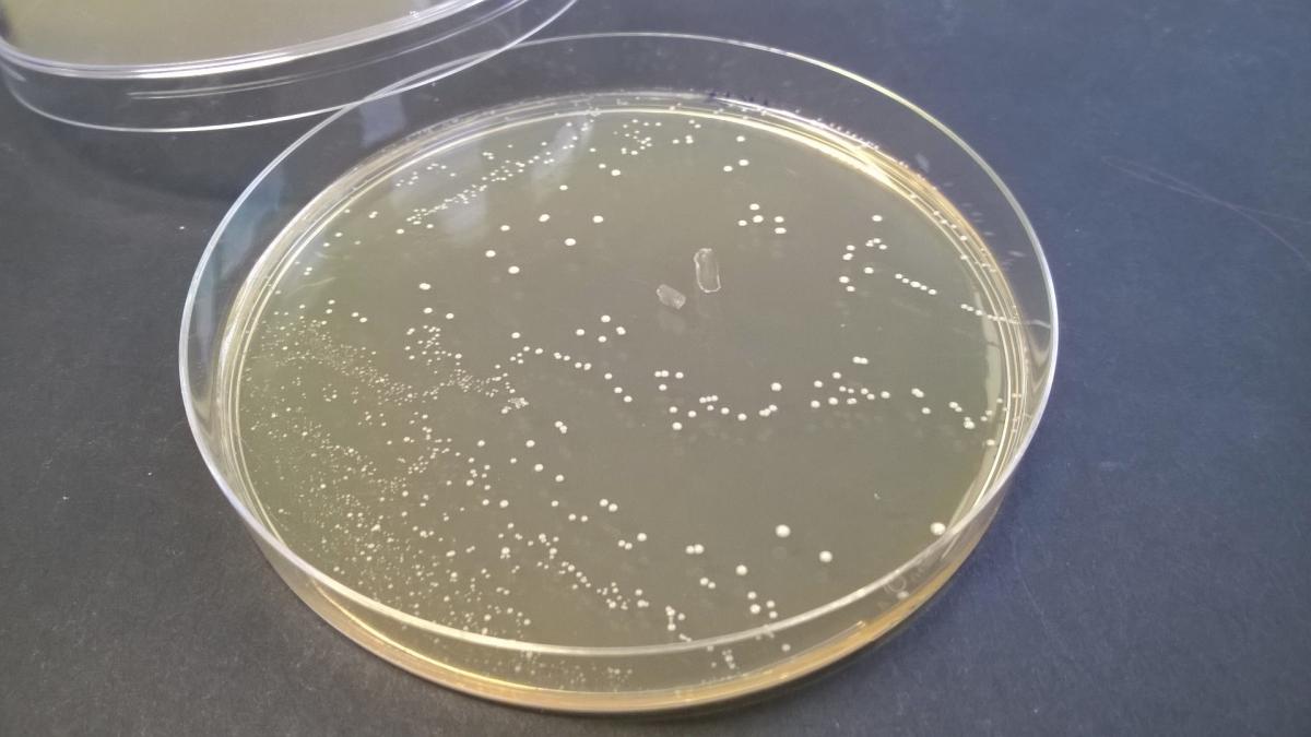 Streptococcus salivarius spp thermophilus