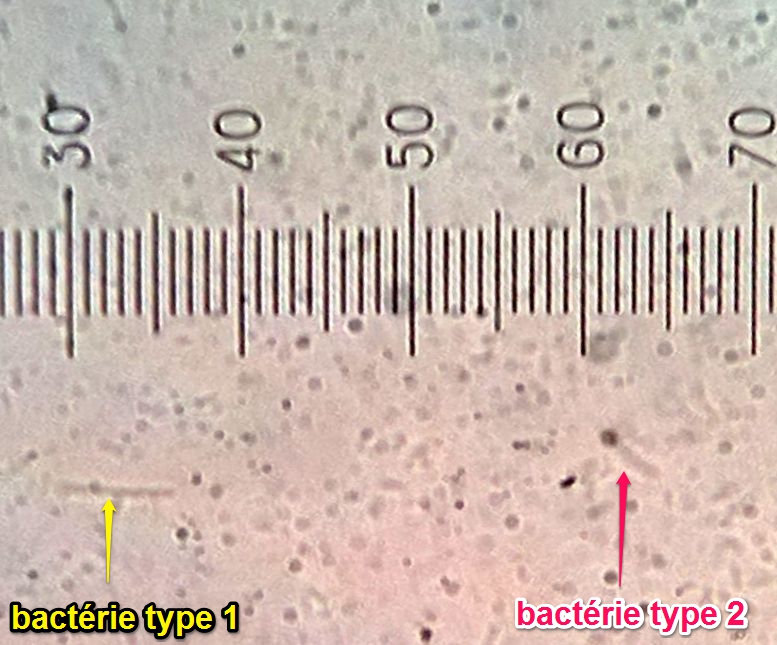 Bacteries gt 400 fois sur leica
