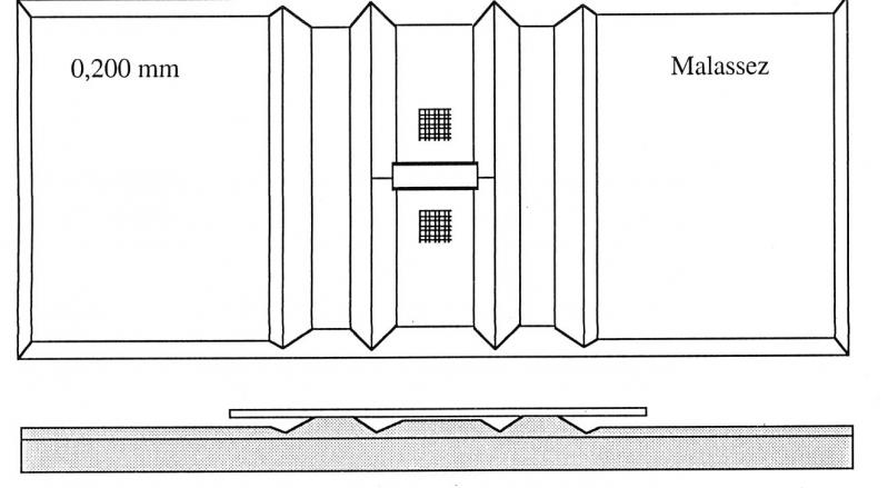 Cellules malassez 4