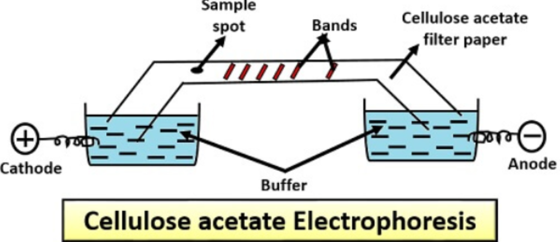 Electrop acetate support 1