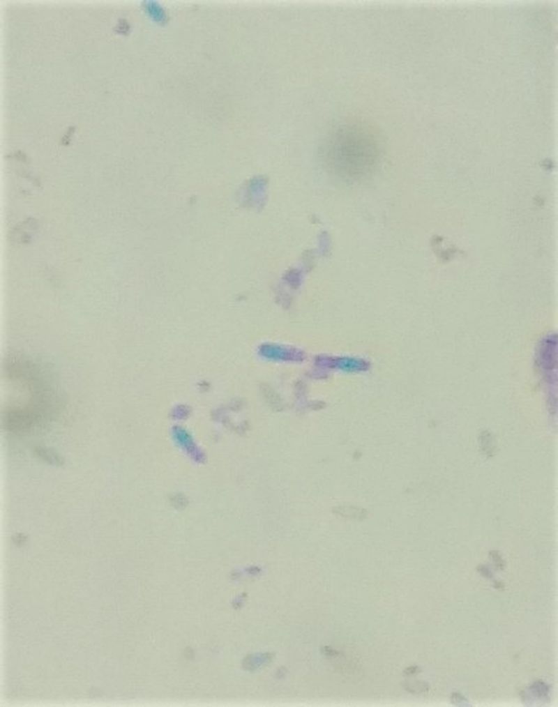 Endospore bacillus