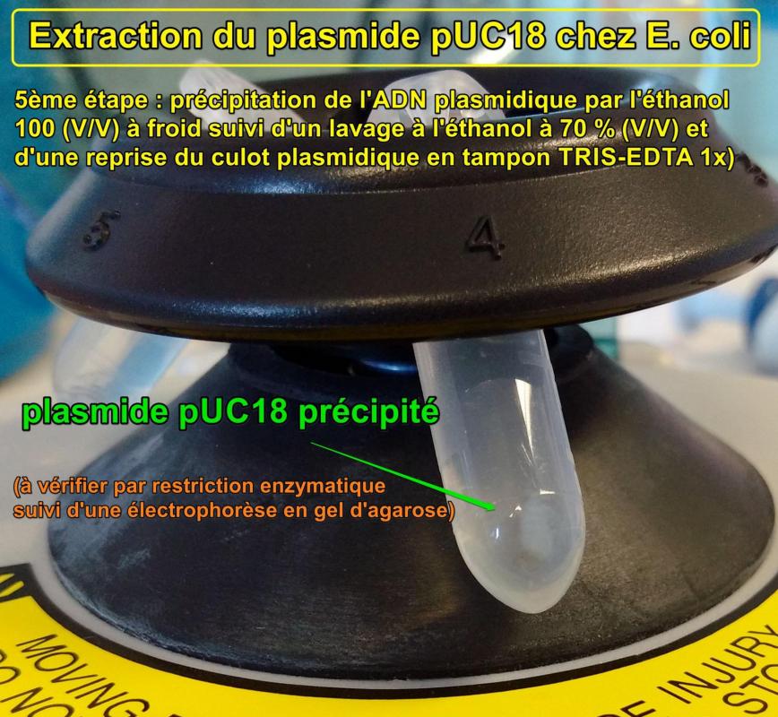 Extraction plasmide 5b adn plasmidique