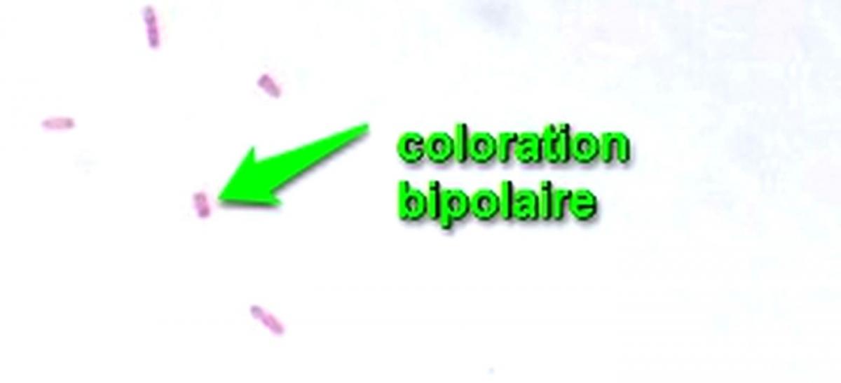 Gram e coli col bipolaire