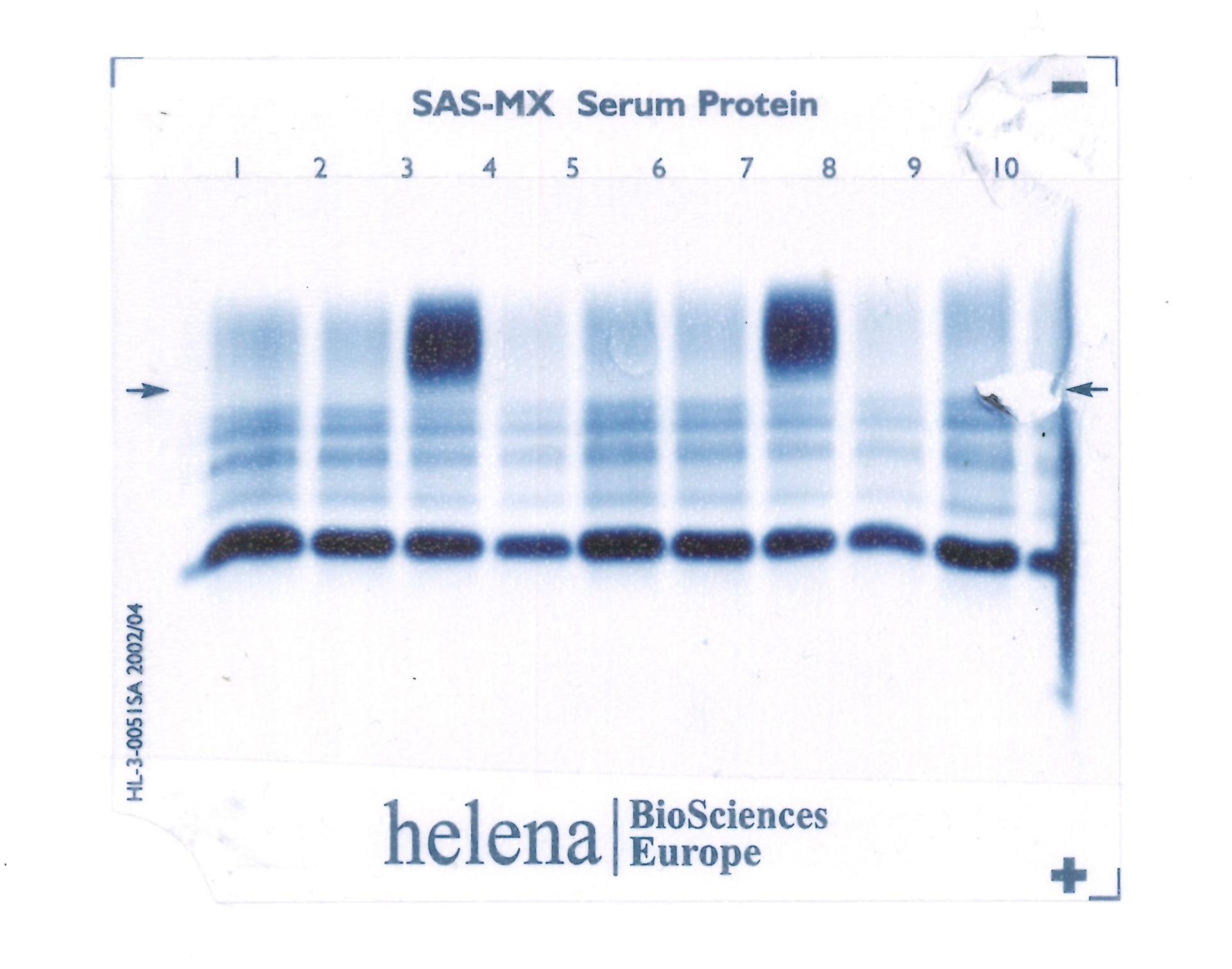 Proteinogramme helena sasmx