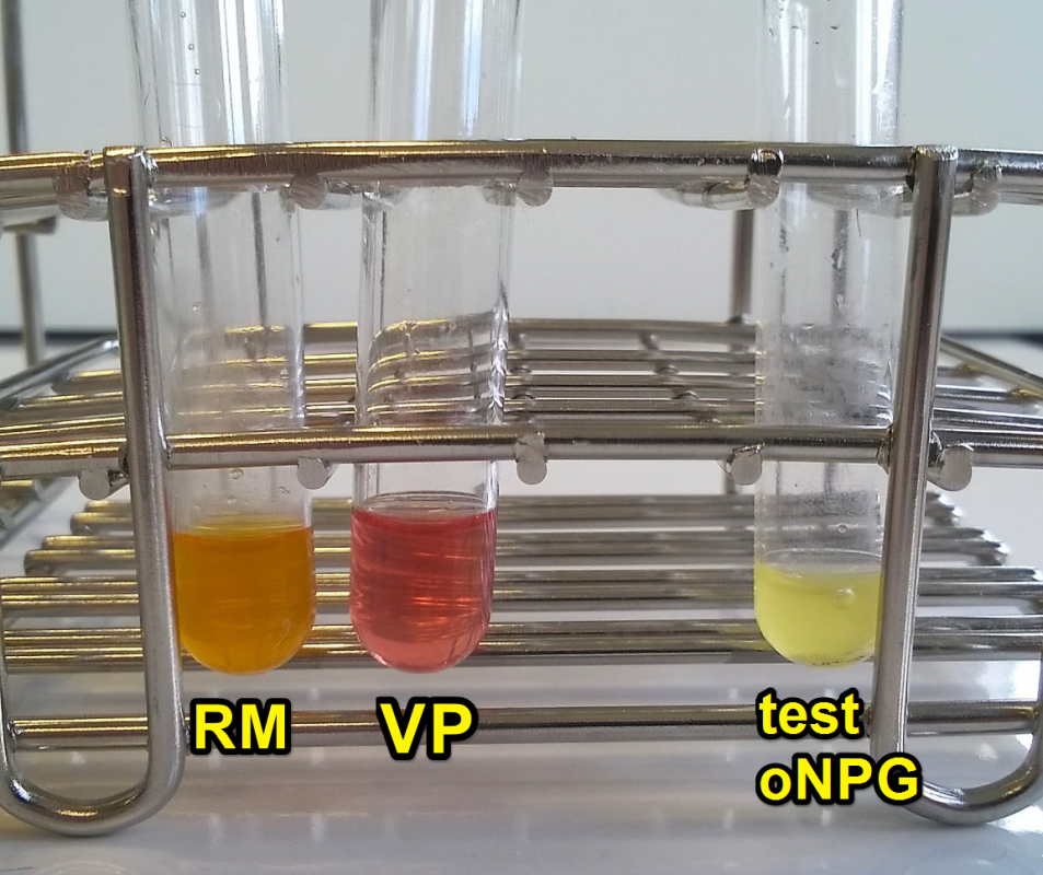 Serratia cl onpg