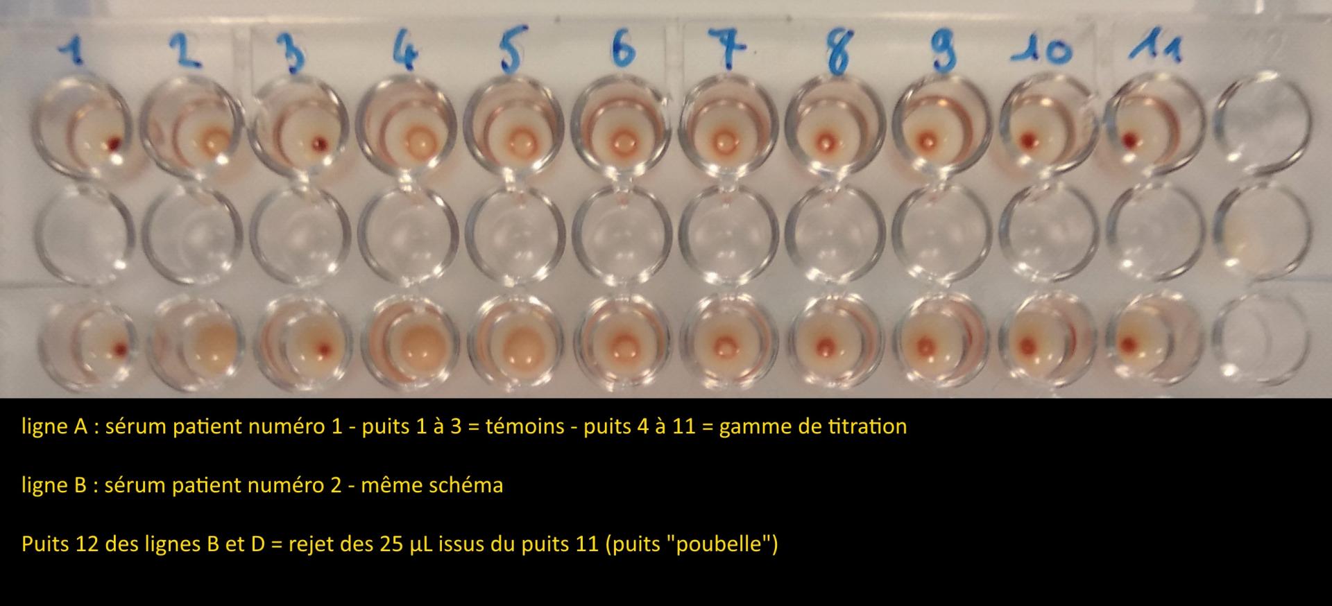 Treponema Pallidum Particle Agglutination Assay Wikipedia, 52% OFF